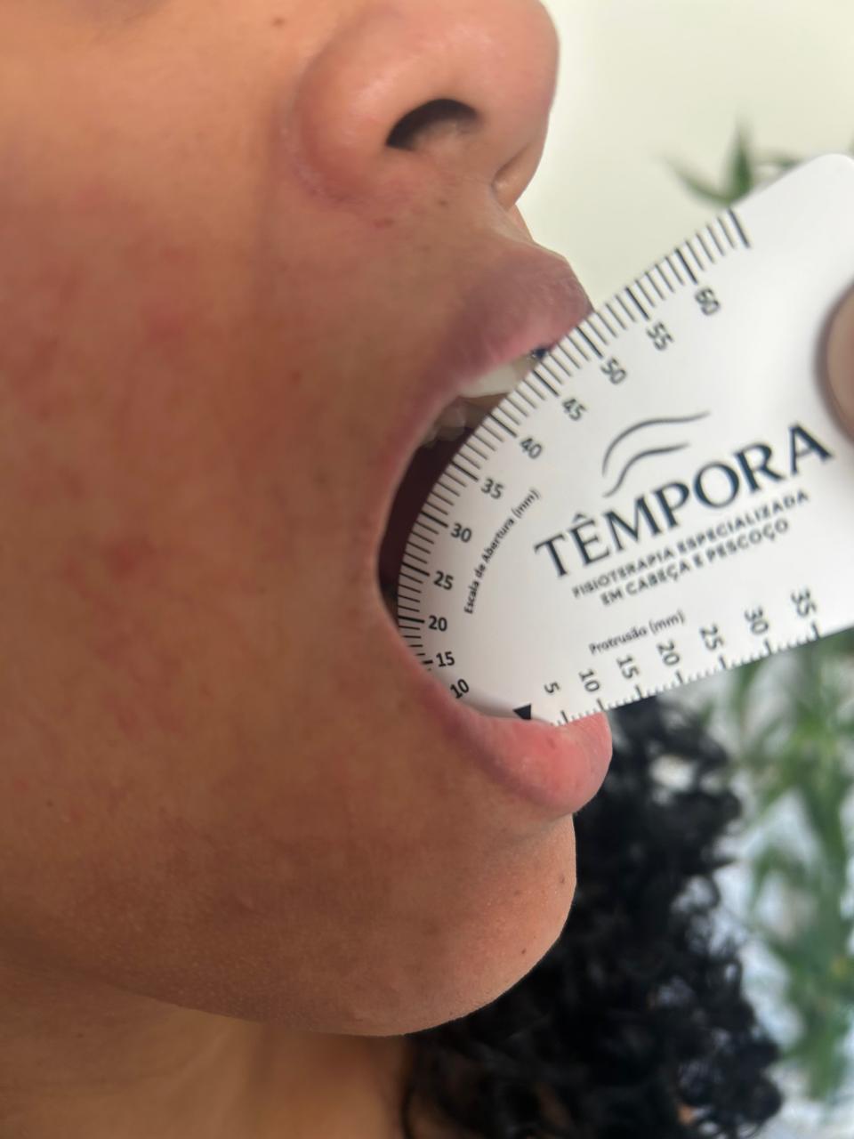 Mapeamento Funcional da abertura mandibular na Têmpora